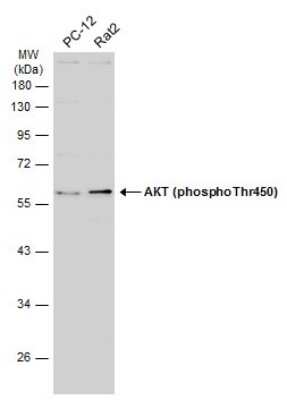 Western Blot: AKT [p Thr450] Antibody [NBP3-13168]